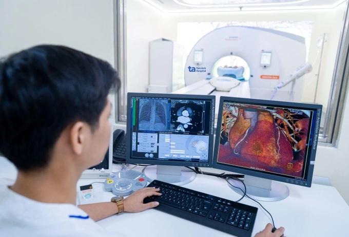 Ai nên chụp CT tầm soát nhồi máu cơ tim?